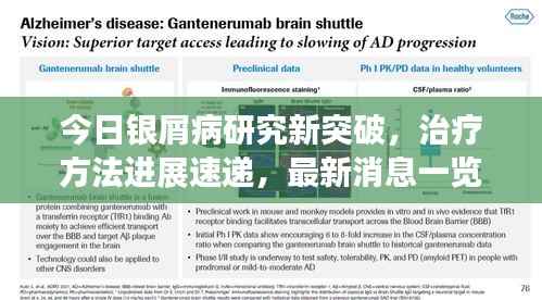 今日银屑病研究新突破，治疗方法进展速递，最新消息一览